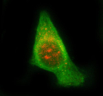 Immunofluorescent staining of STAM2 using anti-STAM2 antibody (red) and anti-Beta Tubulin antibody (green). STAM2 was detected in immunocytochemical section of PC-3 cell. Enzyme antigen retrieval was performed using IHC enzyme antigen retrieval reagent for 15 mins. The cells were blocked with 10% goat serum. And then incubated with 5 ug/ml rabbit anti-STAM2 antibody and mouse anti-Beta Tubulin antibody overnight at 4oC. Cy3 Conjugated Goat Anti-Rabbit IgG and DyLight 488 Conjugated Goat Anti-Mouse IgG were used as secondary antibody at 1:500 dilution and incubated for 30 minutes at 37oC. Visualize using a fluorescence microscope and filter sets appropriate for the label used. U2OS cells were stained with STAM2 antibody (red) and Beta-tubulin antibody (green). STAM2 displays cytoplasmic punctate staining, concentrated in the perinuclear region consistent with its association with early/sorting endosomes. The vesicular STAM2 signal partially aligns with the microtubule network, reflecting its role in endosome trafficking along microtubule tracks.