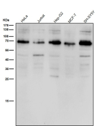 All lanes use the ACBD3 antibody at 1:1K dilution for 1 hour at room temperature. A single major band is detected just below the 70 kDa marker, consistent with the expected migration of full-length ACBD3, which typically runs above its predicted 61 kDa mass due to phosphorylation and the structured coiled-coil/GOLD domains that alter SDS-PAGE mobility. The observed band therefore represents the mature, Golgi-associated form of ACBD3.