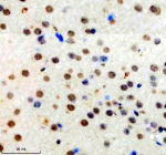 Immunohistochemical staining of TOPBP1 using anti-TOPBP1 antibody. TOPBP1 was detected in a paraffin-embedded section of mouse brain tissue. Heat mediated antigen retrieval was performed in EDTA buffer (pH 8.0, epitope retrieval solution). The tissue section was blocked with 10% goat serum. The tissue section was then incubated with 2 ug/ml rabbit anti-TOPBP1 antibody overnight at 4oC. Peroxidase Conjugated Goat Anti-rabbit IgG was used as secondary antibody and incubated for 30 minutes at 37oC. The tissue section was developed using an HRP secondary and DAB substrate.