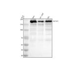 Western blot analysis of TOPBP1 using anti-TOPBP1 antibody. Electrophoresis was performed on a 8% SDS-PAGE gel at 80V (Stacking gel) / 120V (Resolving gel) for 2 hours. Lane 1: human Hela whole cell lysates, Lane 2: human HT1080 whole cell lysates, Lane 3: human HEL whole cell lysates. After electrophoresis, proteins were transferred to a nitrocellulose membrane at 150 mA for 50-90 minutes. Blocked the membrane with 5% non-fat milk/TBS for 1.5 hour at RT. The membrane was incubated with rabbit anti-TOPBP1 antibody at 0.5 ug/ml overnight at 4oC, then washed with TBS-0.1%Tween 3 times with 5 minutes each and probed with a goat anti-rabbit IgG-HRP secondary antibody at a dilution of 1:5000 for 1.5 hour at RT. The signal was developed using an ECL Plus Western Blotting Substrate. The expected molecular weight of TOPBP1 is ~170 kDa.