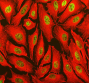 Immunohistochemical staining of TOPBP1 using anti-TOPBP1 antibody. TOPBP1 was detected in a paraffin-embedded section of rat brain tissue. Heat mediated antigen retrieval was performed in EDTA buffer (pH 8.0, epitope retrieval solution). The tissue section was blocked with 10% goat serum. The tissue section was then incubated with 2 ug/ml rabbit anti-TOPBP1 antibody overnight at 4oC. Peroxidase Conjugated Goat Anti-rabbit IgG was used as secondary antibody and incubated for 30 minutes at 37oC. The tissue section was developed using an HRP secondary and DAB substrate.