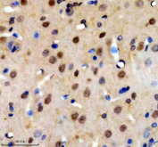 Immunohistochemical staining of TOPBP1 using anti-TOPBP1 antibody. TOPBP1 was detected in a paraffin-embedded section of rat brain tissue. Heat mediated antigen retrieval was performed in EDTA buffer (pH 8.0, epitope retrieval solution). The tissue section was blocked with 10% goat serum. The tissue section was then incubated with 2 ug/ml rabbit anti-TOPBP1 antibody overnight at 4oC. Peroxidase Conjugated Goat Anti-rabbit IgG was used as secondary antibody and incubated for 30 minutes at 37oC. The tissue section was developed using an HRP secondary and DAB substrate.