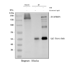 Immunoprecipitating (IP) TOPBP1 in Hela whole cell lysate. Western blot analysis of TOPBP1 using anti-TOPBP1 antibody; Lane 1: Hela whole cell lysates (30ug); Lane 2: Rabbit control IgG instead of anti-TOPBP1 antibody in Hela whole cell lysate; Lane 3: anti-TOPBP1 antibody (2ug) + Hela whole cell lysate (500ug). After electrophoresis, proteins were transferred to a membrane. Then the membrane was incubated with rabbit anti-TOPBP1 antibody at a dilution of 0.5 ug/ml and probed with a goat anti-rabbit IgG-HRP secondary antibody. The signal is developed using ECL Plus Western Blotting Substrate. A specific band was detected for TOPBP1 at approximately 170 kDa. The expected molecular weight of TOPBP1 is at 170 kDa.