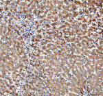Immunohistochemical staining of PDZK1 using anti-PDZK1 antibody. PDZK1 was detected in a paraffin-embedded section of human liver tissue. Heat mediated antigen retrieval was performed in EDTA buffer (pH 8.0, epitope retrieval solution). The tissue section was blocked with 10% goat serum. The tissue section was then incubated with 2 ug/ml rabbit anti-PDZK1 antibody overnight at 4oC. Peroxidase Conjugated Goat Anti-rabbit IgG was used as secondary antibody and incubated for 30 minutes at 37oC. The tissue section was developed using an HRP secondary and DAB substrate.