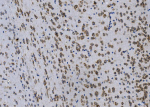 Immunohistochemical staining of GPNMB using anti-GPNMB antibody. GPNMB was detected in paraffin-embedded section of mouse brain tissue. Heat mediated antigen retrieval was performed in EDTA buffer (pH 8.0, epitope retrieval solution). The tissue section was blocked with 10% goat serum. The tissue section was then incubated with 1ug/ml rabbit anti-GPNMB antibody overnight at 4oC. Biotinylated goat anti-rabbit IgG was used as secondary antibody and incubated for 30 minutes at 37oC. The tissue section was developed using Strepavidin-Biotin-Complex (SABC) with DAB as the chromogen.