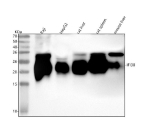 Western blot analysis of IFI30 using anti-IFI30 antibody. Lane 1: human Raji whole cell lysates, Lane 2: human HepG2 whole cell lysates, Lane 3: rat liver tissue lysates, Lane 4: rat spleen tissue lysates, Lane 5: mouse liver tissue lysates. After electrophoresis, proteins were transferred to a nitrocellulose membrane at 150 mA for 50-90 minutes. Blocked the membrane with 5% non-fat milk/TBS for 1.5 hour at RT. The membrane was incubated with rabbit anti-IFI30 antibody at 0.25 ug/ml overnight at 4oC, then washed with TBS-0.1%Tween 3 times with 5 minutes each and probed with a goat anti-rabbit IgG-HRP secondary antibody at a dilution of 1:5000 for 1.5 hour at RT. The signal was developed using enhanced chemiluminescent. IFI30 antibody detects a predominant band at ~23 kDa with a minor band at ~30 kDa across the indicated lysates. IFI30 is synthesized as a ~35 kDa glycoprotein and processed in the endo-lysosomal pathway to a mature form typically near ~28-30 kDa; additional C-terminal trimming and glycosylation differences can yield a smaller ~23-24 kDa species. The observed pattern is consistent with mature IFI30 predominating alongside a minor precursor or intermediate.