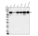Western blot analysis of PFKM using anti-PFKM antibody. Lane 1: human Hela whole cell lysates, Lane 2: human HepG2 whole cell lysates, Lane 3: human 293T whole cell lysates, Lane 4: human U-87MG whole cell lysates, Lane 5: rat heart tissue lysates, Lane 6: mouse heart tissue lysates. After electrophoresis, proteins were transferred to a nitrocellulose membrane at 150 mA for 50-90 minutes. Blocked the membrane with 5% non-fat milk/TBS for 1.5 hour at RT. The membrane was incubated with rabbit anti-PFKM antibody at 0.5 ug/ml overnight at 4oC, then washed with TBS-0.1%Tween 3 times with 5 minutes each and probed with a goat anti-rabbit IgG-HRP secondary antibody at a dilution of 1:5000 for 1.5 hour at RT. The signal was developed using enhanced chemiluminescent. A specific band was detected for PFKM at approximately 85 kDa. The expected molecular weight of PFKM is ~85 kDa.