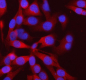Immunofluorescent staining of FFPE human HeLa cells with PFKM antibody (red) and DAPI nuclear stain (blue). HIER: steam section in pH6 citrate buffer for 20 min.