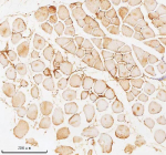 Immunohistochemical staining of PFKM using anti-PFKM antibody. PFKM was detected in a paraffin-embedded section of mouse skeletal muscle tissue. Heat mediated antigen retrieval was performed in EDTA buffer (pH 8.0, epitope retrieval solution). The tissue section was blocked with 10% goat serum. The tissue section was then incubated with 2 ug/ml rabbit anti-PFKM antibody overnight at 4oC. Peroxidase Conjugated Goat Anti-rabbit IgG was used as secondary antibody and incubated for 30 minutes at 37oC. The tissue section was developed using an HRP secondary and DAB substrate.