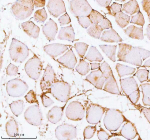 Immunohistochemical staining of PFKM using anti-PFKM antibody. PFKM was detected in a paraffin-embedded section of mouse skeletal muscle tissue. Heat mediated antigen retrieval was performed in EDTA buffer (pH 8.0, epitope retrieval solution). The tissue section was blocked with 10% goat serum. The tissue section was then incubated with 2 ug/ml rabbit anti-PFKM antibody overnight at 4oC. Peroxidase Conjugated Goat Anti-rabbit IgG was used as secondary antibody and incubated for 30 minutes at 37oC. The tissue section was developed using an HRP secondary and DAB substrate.