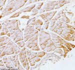 Immunohistochemical staining of PFKM using anti-PFKM antibody. PFKM was detected in a paraffin-embedded section of rat skeletal muscle tissue. Heat mediated antigen retrieval was performed in EDTA buffer (pH 8.0, epitope retrieval solution). The tissue section was blocked with 10% goat serum. The tissue section was then incubated with 2 ug/ml rabbit anti-PFKM antibody overnight at 4oC. Peroxidase Conjugated Goat Anti-rabbit IgG was used as secondary antibody and incubated for 30 minutes at 37oC. The tissue section was developed using an HRP secondary and DAB substrate.