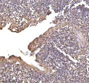 Immunohistochemical staining of RSRC2 using anti-RSRC2 antibody. RSRC2 was detected in a paraffin-embedded section of human tonsil tissue. Heat mediated antigen retrieval was performed in EDTA buffer (pH 8.0, epitope retrieval solution). The tissue section was blocked with 10% goat serum. The tissue section was then incubated with 2 ug/ml rabbit anti-RSRC2 antibody overnight at 4oC. Peroxidase Conjugated Goat Anti-rabbit IgG was used as secondary antibody and incubated for 30 minutes at 37oC. The tissue section was developed using an HRP secondary and DAB substrate.
