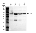 Western blot analysis of P4HA1 using anti-P4HA1 antibody. Electrophoresis was performed on a 10% SDS-PAGE gel at 80V (Stacking gel) / 120V (Resolving gel) for 2 hours. Lane 1: human 293T whole cell lysates, Lane 2: human HepG2 whole cell lysates, Lane 3: human Hela whole cell lysates, Lane 4: human MCF-7 whole cell lysates. After electrophoresis, proteins were transferred to a nitrocellulose membrane at 150 mA for 50-90 minutes. Blocked the membrane with 5% non-fat milk/TBS for 1.5 hour at RT. The membrane was incubated with rabbit anti-P4HA1 antibody at 1:1000 overnight at 4oC, then washed with TBS-0.1%Tween 3 times with 5 minutes each and probed with a goat anti-rabbit IgG-HRP secondary antibody at a dilution of 1:5000 for 1.5 hour at RT. The signal was developed using an ECL Plus Western Blotting Substrate. A specific band was detected for P4HA1 at approximately 61 kDa. The expected molecular weight of P4HA1 is ~61 kDa.