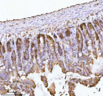 Cdh1 Antibody Rat Colon IHC. Immunohistochemical staining of E-Cadherin/Cdh1 using anti-Cdh1 antibody. E-Cadherin/Cdh1 was detected in a paraffin-embedded section of rat colon tissue. Heat mediated antigen retrieval was performed in EDTA buffer (pH 8.0, epitope retrieval solution). The tissue section was blocked with 10% goat serum. The tissue section was then incubated with 2 ug/ml rabbit anti-Cdh1 antibody overnight at 4oC. Peroxidase Conjugated Goat Anti-rabbit IgG was used as secondary antibody and incubated for 30 minutes at 37oC. The tissue section was developed using an HRP secondary and DAB substrate.