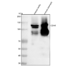 Cdh1 Antibdoy Mouse Testis and Stomach Western blot analysis of E-Cadherin/Cdh1 using anti-Cdh1 antibody. Lane 1: mouse testis tissue lysates, Lane 2: mouse stomach tissue lysates. After electrophoresis, proteins were transferred to a nitrocellulose membrane at 150 mA for 50-90 minutes. Blocked the membrane with 5% non-fat milk/TBS for 1.5 hour at RT. The membrane was incubated with rabbit anti-Cdh1 antibody at 0.5 ug/ml overnight at 4oC, then washed with TBS-0.1%Tween 3 times with 5 minutes each and probed with a goat anti-rabbit IgG-HRP secondary antibody at a dilution of 1:5000 for 1.5 hour at RT. The signal was developed using enhanced chemiluminescent. Cdh1/E-cadherin antibody detects a strong doublet at ~120-130 kDa in mouse testis and stomach, consistent with mature and pro/variably glycosylated E-cadherin. Additional bands near ~90â95 kDa likely represent immature or partially deglycosylated species and may include proteolytic products.