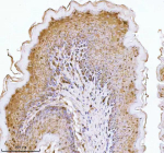 Immunohistochemical staining of E-Cadherin/Cdh1 using anti-Cdh1 antibody. E-Cadherin/Cdh1 was detected in a paraffin-embedded section of rat stomach tissue. Heat mediated antigen retrieval was performed in EDTA buffer (pH 8.0, epitope retrieval solution). The tissue section was blocked with 10% goat serum. The tissue section was then incubated with 2 ug/ml rabbit anti-Cdh1 antibody overnight at 4oC. Peroxidase Conjugated Goat Anti-rabbit IgG was used as secondary antibody and incubated for 30 minutes at 37oC. The tissue section was developed using an HRP secondary and DAB substrate.