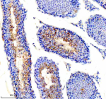 Immunohistochemical staining of PICK1 using anti-PICK1 antibody. PICK1 was detected in a paraffin-embedded section of mouse testis tissue. Heat mediated antigen retrieval was performed in EDTA buffer (pH 8.0, epitope retrieval solution). The tissue section was blocked with 10% goat serum. The tissue section was then incubated with 2 ug/ml rabbit anti-PICK1 antibody overnight at 4oC. Peroxidase Conjugated Goat Anti-rabbit IgG was used as secondary antibody and incubated for 30 minutes at 37oC. The tissue section was developed using an HRP secondary and DAB substrate.