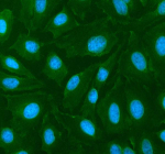 Immunofluorescent staining of CYP26B1 using anti-CYP26B1 antibody (green). CYP26B1 was detected in an immunocytochemical section of U2OS cells. Enzyme antigen retrieval was performed using IHC enzyme antigen retrieval reagent for 15 mins. The cells were blocked with 10% goat serum. And then incubated with 5 ug/ml rabbit anti-CYP26B1 antibody overnight at 4oC. DyLight 488 Conjugated Goat Anti-Rabbit IgG was used as secondary antibody at 1:500 dilution and incubated for 30 minutes at 37oC. The section was counterstained with DAPI nuclear stain (blue). Visualize using a fluorescence microscope and filter sets appropriate for the label used.