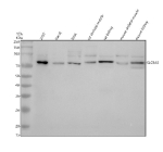 Western blot analysis of SLC9A8 using anti-SLC9A8 antibody. Electrophoresis was performed on a 10% SDS-PAGE gel at 80V (Stacking gel) / 120V (Resolving gel) for 2 hours. Lane 1: human 293T whole cell lysates, Lane 2: human Hacat whole cell lysates, Lane 3: human SIHA whole cell lysates, Lane 4: rat skeletal muscle tissue lysates, Lane 5: rat kidney tissue lysates, Lane 6: mouse skeletal muscle tissue lysates, Lane 7: mouse kidney tissue lysates. After electrophoresis, proteins were transferred to a nitrocellulose membrane at 150 mA for 50-90 minutes. Blocked the membrane with 5% non-fat milk/TBS for 1.5 hour at RT. The membrane was incubated with rabbit anti-SLC9A8 antibody at 0.5 ug/ml overnight at 4oC, then washed with TBS-0.1%Tween 3 times with 5 minutes each and probed with a goat anti-rabbit IgG-HRP secondary antibody at a dilution of 1:5000 for 1.5 hour at RT. The signal was developed using an ECL Plus Western Blotting Substrate. SLC9A8 antibody detects a single band at ~75 kDa across human and mouse tissues. Although the predicted molecular weight is ~65 kDa, NHE8 is a heavily glycosylated multi-pass membrane transporter that typically migrates at ~70-80 kDa on SDS-PAGE.