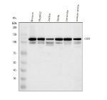 Western blot analysis of LIG4 using anti-LIG4 antibody. Electrophoresis was performed on a 8% SDS-PAGE gel at 80V (Stacking gel) / 120V (Resolving gel) for 2 hours. Lane 1: human Ramos whole cell lysates, Lane 2: human HepG2 whole cell lysates, Lane 3: human jurkat whole cell lysates, Lane 4: human Hela whole cell lysates, Lane 5: rat testis tissue lysates, Lane 6: mouse testis tissue lysates. After electrophoresis, proteins were transferred to a nitrocellulose membrane at 150 mA for 50-90 minutes. Blocked the membrane with 5% non-fat milk/TBS for 1.5 hour at RT. The membrane was incubated with rabbit anti-LIG4 antibody at 0.5 ug/ml overnight at 4oC, then washed with TBS-0.1%Tween 3 times with 5 minutes each and probed with a goat anti-rabbit IgG-HRP secondary antibody at a dilution of 1:5000 for 1.5 hour at RT. The signal was developed using an ECL Plus Western Blotting Substrate. LIG4 antibody detects a primary band at ~110 kDa across the indicated human and rodent lysates, consistent with full-length DNA ligase IV. Although the theoretical mass is ~104 kDa, slower migration is typical due to phosphorylation and the acidic C-terminal domain. Additional weaker bands just below 100 kDa likely represent partially dephosphorylated or proteolytically processed forms of LIG4.