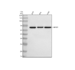 Western blot analysis of LMBRD1 using anti-LMBRD1 antibody. Electrophoresis was performed on a 10% SDS-PAGE gel at 80V (Stacking gel) / 120V (Resolving gel) for 2 hours. Lane 1: human 293T whole cell lysates, Lane 2: human RT4 whole cell lysates, Lane 3: human K562 whole cell lysates. After electrophoresis, proteins were transferred to a nitrocellulose membrane at 150 mA for 50-90 minutes. Blocked the membrane with 5% non-fat milk/TBS for 1.5 hour at RT. The membrane was incubated with rabbit anti-LMBRD1 antibody at 0.5 ug/ml overnight at 4oC, then washed with TBS-0.1%Tween 3 times with 5 minutes each and probed with a goat anti-rabbit IgG-HRP secondary antibody at a dilution of 1:5000 for 1.5 hour at RT. The signal was developed using an ECL Plus Western Blotting Substrate. A specific band was detected for LMBRD1 at approximately 61 kDa. The expected molecular weight of LMBRD1 is ~61 kDa.
