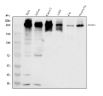 Western blot analysis of TCOF1 using anti-TCOF1 antibody. Electrophoresis was performed on a 8% SDS-PAGE gel at 80V (Stacking gel) / 120V (Resolving gel) for 2 hours. Lane 1: human Hela whole cell lysates, Lane 2: human Jurkat whole cell lysates, Lane 3: human Caco-2 whole cell lysates, Lane 4: human whole cell lysates. After electrophoresis, proteins were transferred to a nitrocellulose membrane at 150 mA for 50-90 minutes. Blocked the membrane with 5% non-fat milk/TBS for 1.5 hour at RT. The membrane was incubated with rabbit anti-TCOF1 antibody at 0.5 ug/ml overnight at 4oC, then washed with TBS-0.1%Tween 3 times with 5 minutes each and probed with a goat anti-rabbit IgG-HRP secondary antibody at a dilution of 1:5000 for 1.5 hour at RT. The signal was developed using an ECL Plus Western Blotting Substrate. TCOF1/Treacle antibody detects a prominent band at ~240-250 kDa across the indicated samples. Although the predicted mass is ~150 kDa, Treacle contains long acidic repeats and extensive phosphorylation that cause markedly slower SDS-PAGE migration, a well-known property of this nucleolar protein.