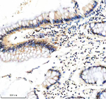 Immunohistochemical staining of FBXO7 using anti-FBXO7 antibody. FBXO7 was detected in a paraffin-embedded section of human colon tissue. Heat mediated antigen retrieval was performed in EDTA buffer (pH 8.0, epitope retrieval solution). The tissue section was blocked with 10% goat serum. The tissue section was then incubated with 2 ug/ml rabbit anti-FBXO7 antibody overnight at 4oC. Peroxidase Conjugated Goat Anti-rabbit IgG was used as secondary antibody and incubated for 30 minutes at 37oC. The tissue section was developed using an HRP secondary and DAB substrate.