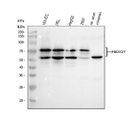 Western blot analysis of FBXO7 using anti-FBXO7 antibody. Electrophoresis was performed on a 10% SDS-PAGE gel at 80V (Stacking gel) / 120V (Resolving gel) for 2 hours. Lane 1: human HUVEC whole cell lysates, Lane 2: human HEL whole cell lysates, Lane 3: human HepG2 whole cell lysates, Lane 4: human 293T whole cell lysates, Lane 5: rat lung tissue lysates, Lane 6: rat small intestine tissue lysates. After electrophoresis, proteins were transferred to a nitrocellulose membrane at 150 mA for 50-90 minutes. Blocked the membrane with 5% non-fat milk/TBS for 1.5 hour at RT. The membrane was incubated with rabbit anti-FBXO7 antibody at 0.5 ug/ml overnight at 4oC, then washed with TBS-0.1%Tween 3 times with 5 minutes each and probed with a goat anti-rabbit IgG-HRP secondary antibody at a dilution of 1:5000 for 1.5 hour at RT. The signal was developed using an ECL Plus Western Blotting Substrate. FBXO7 antibody detects two bands at ~59 kDa and ~72 kDa in multiple cell and tissue lysates. The ~59 kDa species corresponds to the canonical isoform 1, while the ~72 kDa band likely represents the longer isoform 2 or a post-translationally modified form of FBXO7. Both species are consistently reported in literature.
