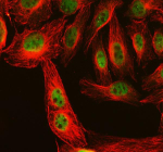 Immunofluorescent staining of FBXO7 using anti-FBXO7 antibody (green) and anti-Beta Tubulin antibody (red). FBXO7 was detected in an immunocytochemical section of U2OS cells. Enzyme antigen retrieval was performed using IHC enzyme antigen retrieval reagent for 15 mins. The cells were blocked with 10% goat serum. And then incubated with 5 ug/ml rabbit anti-FBXO7 antibody and mouse anti-Beta Tubulin antibody overnight at 4oC. DyLight 488 Conjugated Goat Anti-Rabbit IgG and Cy3 Conjugated Goat Anti-Mouse IgG were used as secondary antibody at 1:500 dilution and incubated for 30 minutes at 37oC. Visualize using a fluorescence microscope and filter sets appropriate for the label used.