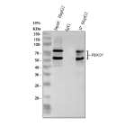 Immunoprecipitating FBXO7 in HepG2 whole cell lysate. Western blot analysis of FBXO7 using anti-FBXO7 antibody. Lane 1: HepG2 whole cell lysates (30ug), Lane 2: Rabbit control IgG instead of anti-FBXO7 antibody in HepG2 whole cell lysate, Lane 3: anti-FBXO7 antibody (2ug) + HepG2 whole cell lysate (500ug). After electrophoresis, proteins were transferred to a membrane. Then the membrane was incubated with rabbit anti-FBXO7 antibody at a dilution of 0.5 ug/ml and probed with a goat anti-rabbit IgG-HRP secondary antibody. The signal is developed using ECL Plus Western Blotting Substrate. FBXO7 antibody detects two bands at ~59 kDa and ~72 kDa in multiple cell and tissue lysates. The ~59 kDa species corresponds to the canonical isoform 1, while the ~72 kDa band likely represents the longer isoform 2 or a post-translationally modified form of FBXO7. Both species are consistently reported in literature.