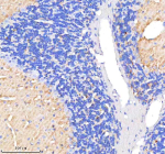 Immunohistochemical staining of CLTB using anti-CLTB antibody. CLTB was detected in a paraffin-embedded section of mouse cerebellum tissue. Heat mediated antigen retrieval was performed in EDTA buffer (pH 8.0, epitope retrieval solution). The tissue section was blocked with 10% goat serum. The tissue section was then incubated with 2 ug/ml rabbit anti-CLTB antibody overnight at 4oC. Peroxidase Conjugated Goat Anti-rabbit IgG was used as secondary antibody and incubated for 30 minutes at 37oC. The tissue section was developed using an HRP secondary and DAB substrate.
