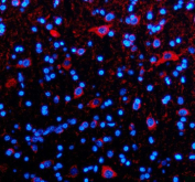 Immunofluorescent staining of TIM10/TIMM10 using anti-TIMM10 antibody (red). TIM10/TIMM10 was detected in a paraffin-embedded section of rat brain tissue. Heat mediated antigen retrieval was performed in EDTA buffer (pH 8.0, epitope retrieval solution). The tissue section was blocked with 10% goat serum. The tissue section was then incubated with 5 ug/ml rabbit anti-TIMM10 antibody overnight at 4oC. Cy3 Conjugated Goat Anti-Rabbit IgG was used as secondary antibody at 1:500 dilution and incubated for 30 minutes at 37oC. The section was counterstained with DAPI nuclear stain (blue). Visualize using a fluorescence microscope and filter sets appropriate for the label used.
