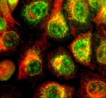 Immunofluorescent staining of TIM10/TIMM10 using anti-TIMM10 antibody (green) and anti-Alpha Tubulin antibody (red). TIM10/TIMM10 was detected in an immunocytochemical section of human A549 cells. Enzyme antigen retrieval was performed using IHC enzyme antigen retrieval reagent for 15 mins. The cells were blocked with 10% goat serum. And then incubated with 5 ug/ml rabbit anti-TIMM10 antibody and mouse anti-Beta Tubulin antibody overnight at 4oC. DyLight 488 Conjugated Goat Anti-Rabbit IgG and Cy3 Conjugated Goat Anti-Mouse IgG were used as secondary antibody at 1:500 dilution and incubated for 30 minutes at 37oC. Visualize using a fluorescence microscope and filter sets appropriate for the label used.
