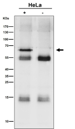 Immunoprecipitation analysis using the SYVN1 antibody at 1:50 dilution. Western blot at 1:1000 dilution. The expected molecular weight of SYVN1 is at 68 kDa.