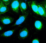 Immunofluorescent staining of TNIP3 using anti-TNIP3 antibody (green). TNIP3 was detected in an immunocytochemical section of human U2OS cells. Enzyme antigen retrieval was performed using IHC enzyme antigen retrieval reagent for 15 mins. The cells were blocked with 10% goat serum. And then incubated with 5 ug/ml rabbit anti-TNIP3 antibody overnight at 4oC. DyLight 488 Conjugated Goat Anti-Rabbit IgG was used as secondary antibody at 1:500 dilution and incubated for 30 minutes at 37oC. The section was counterstained with DAPI nuclear stain (blue). Visualize using a fluorescence microscope and filter sets appropriate for the label used.