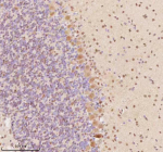 Immunohistochemical staining of AATF using anti-AATF antibody. AATF was detected in a paraffin-embedded section of mouse cerebellum tissue. Heat mediated antigen retrieval was performed in EDTA buffer (pH 8.0, epitope retrieval solution). The tissue section was blocked with 10% goat serum. The tissue section was then incubated with 2 ug/ml rabbit anti-AATF antibody overnight at 4oC. Peroxidase Conjugated Goat Anti-rabbit IgG was used as secondary antibody and incubated for 30 minutes at 37oC. The tissue section was developed using an HRP secondary and DAB substrate.
