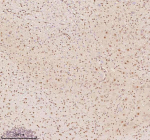 Immunohistochemical staining of AATF using anti-AATF antibody. AATF was detected in a paraffin-embedded section of mouse cerebellum tissue. Heat mediated antigen retrieval was performed in EDTA buffer (pH 8.0, epitope retrieval solution). The tissue section was blocked with 10% goat serum. The tissue section was then incubated with 2 ug/ml rabbit anti-AATF antibody overnight at 4oC. Peroxidase Conjugated Goat Anti-rabbit IgG was used as secondary antibody and incubated for 30 minutes at 37oC. The tissue section was developed using an HRP secondary and DAB substrate.