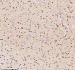 Immunohistochemical staining of AATF using anti-AATF antibody. AATF was detected in a paraffin-embedded section of mouse cerebellum tissue. Heat mediated antigen retrieval was performed in EDTA buffer (pH 8.0, epitope retrieval solution). The tissue section was blocked with 10% goat serum. The tissue section was then incubated with 2 ug/ml rabbit anti-AATF antibody overnight at 4oC. Peroxidase Conjugated Goat Anti-rabbit IgG was used as secondary antibody and incubated for 30 minutes at 37oC. The tissue section was developed using an HRP secondary and DAB substrate.
