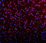 Immunofluorescent staining of AATF using anti-AATF antibody (red). AATF was detected in a paraffin-embedded section of rat brain tissue. Heat mediated antigen retrieval was performed in EDTA buffer (pH 8.0, epitope retrieval solution). The tissue section was blocked with 10% goat serum. The tissue section was then incubated with 5 ug/ml rabbit anti-AATF antibody overnight at 4oC. DyLight 594 Conjugated Goat Anti-Rabbit IgG was used as secondary antibody at 1:500 dilution and incubated for 30 minutes at 37oC. The section was counterstained with DAPI nuclear stain (blue). Visualize using a fluorescence microscope and filter sets appropriate for the label used.