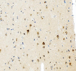 Immunohistochemical staining of AATF using anti-AATF antibody. AATF was detected in a paraffin-embedded section of human brain tissue. Heat mediated antigen retrieval was performed in EDTA buffer (pH 8.0, epitope retrieval solution). The tissue section was blocked with 10% goat serum. The tissue section was then incubated with 2 ug/ml rabbit anti-AATF antibody overnight at 4oC. Peroxidase Conjugated Goat Anti-rabbit IgG was used as secondary antibody and incubated for 30 minutes at 37oC. The tissue section was developed using an HRP secondary and DAB substrate.