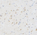 Immunohistochemical staining of AATF using anti-AATF antibody. AATF was detected in a paraffin-embedded section of human brain tissue. Heat mediated antigen retrieval was performed in EDTA buffer (pH 8.0, epitope retrieval solution). The tissue section was blocked with 10% goat serum. The tissue section was then incubated with 2 ug/ml rabbit anti-AATF antibody overnight at 4oC. Peroxidase Conjugated Goat Anti-rabbit IgG was used as secondary antibody and incubated for 30 minutes at 37oC. The tissue section was developed using an HRP secondary and DAB substrate.