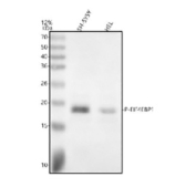 Western blot analysis of Phospho-eIF4EBP1 using anti-Phospho-eIF4EBP1 (Thr70) antibody. Electrophoresis was performed on a 12% SDS-PAGE gel at 80V (Stacking gel) / 120V (Resolving gel) for 2 hours. Lane 1: human SH-SY5Y whole cell lysates, Lane 2: human HEL whole cell lysates. After electrophoresis, proteins were transferred to a nitrocellulose membrane at 150 mA for 50-90 minutes. Blocked the membrane with 5% non-fat milk/TBS for 1.5 hour at RT. The membrane was incubated with rabbit anti-Phospho-eIF4EBP1 (Thr70) antibody at 1:500 overnight at 4oC, then washed with TBS-0.1%Tween 3 times with 5 minutes each and probed with a goat anti-rabbit IgG-HRP secondary antibody at a dilution of 1:5000 for 1.5 hour at RT. The signal was developed using an ECL Plus Western Blotting Substrate. The expected molecular weight of Phospho-eIF4EBP1 is ~17 kDa.