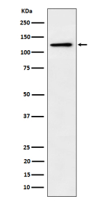 Western blot analysis of Palladin expression in cell lysate using PALLD antibody. PALLD antibody detects a band migrating at ~125-135 kDa in the indicated cell lysates, consistent with the 140-kDa Palladin isoform. Minor gel-to-gel variation reflects phosphorylation-dependent mobility and cytoskeletal protein behavior. Lower fragments (when present) are attributed to regulated proteolysis.