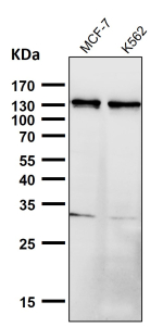 Western blot testing of human samples using the PALLD antibody at 1:3000 dilution for 1 hour at room temperature. PALLD antibody detects a band migrating at ~125-135 kDa in the indicated cell lysates, consistent with the 140-kDa Palladin isoform. Minor gel-to-gel variation reflects phosphorylation-dependent mobility and cytoskeletal protein behavior. Lower fragments (when present) are attributed to regulated proteolysis.