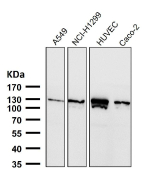 Western blot testing of human samples using the PALLD antibody at 1:3000 dilution for 1 hour at room temperature. PALLD antibody detects a band migrating at ~125-135 kDa in the indicated cell lysates, consistent with the 140-kDa Palladin isoform. Minor gel-to-gel variation reflects phosphorylation-dependent mobility and cytoskeletal protein behavior. Lower fragments (when present) are attributed to regulated proteolysis.