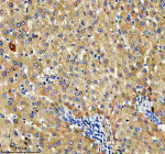 Immunohistochemical staining of NSDHL using anti-NSDHL antibody. NSDHL was detected in a paraffin-embedded section of human liver tissue. Heat mediated antigen retrieval was performed in EDTA buffer (pH 8.0, epitope retrieval solution). The tissue section was blocked with 10% goat serum. The tissue section was then incubated with 2 ug/ml rabbit anti-NSDHL antibody overnight at 4oC. Peroxidase Conjugated Goat Anti-rabbit IgG was used as secondary antibody and incubated for 30 minutes at 37oC. The tissue section was developed using an HRP secondary and DAB substrate.