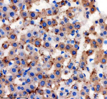 Immunohistochemical staining of NSDHL using anti-NSDHL antibody. NSDHL was detected in a paraffin-embedded section of rat liver tissue. Heat mediated antigen retrieval was performed in EDTA buffer (pH 8.0, epitope retrieval solution). The tissue section was blocked with 10% goat serum. The tissue section was then incubated with 2 ug/ml rabbit anti-NSDHL antibody overnight at 4oC. Peroxidase Conjugated Goat Anti-rabbit IgG was used as secondary antibody and incubated for 30 minutes at 37oC. The tissue section was developed using an HRP secondary and DAB substrate.