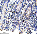 Immunohistochemical staining of CD163L1 using anti-CD163L1 antibody. CD163L1 was detected in a paraffin-embedded section of human appendix tissue. Heat mediated antigen retrieval was performed in EDTA buffer (pH 8.0, epitope retrieval solution). The tissue section was blocked with 10% goat serum. The tissue section was then incubated with a dilution of 1:50 rabbit anti-CD163L1 antibody overnight at 4oC. Peroxidase Conjugated Goat Anti-rabbit IgG was used as secondary antibody and incubated for 30 minutes at 37oC. The tissue section was developed using an HRP secondary and DAB substrate.