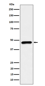 Western blot analysis of CECR5/HDHD5 expression in HepG2 cell lysate using HDHD5 antibody. Predicted molecular weight ~46 kDa.