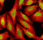 Immunofluorescent staining of TGIF2 using anti-TGIF2 antibody (green) and anti-Beta Tubulin antibody (red). TGIF2 was detected in an immunocytochemical section of U2OS cells and shows the expected nucleus and centrosome staining. Enzyme antigen retrieval was performed using IHC enzyme antigen retrieval reagent for 15 mins. The cells were blocked with 10% goat serum. And then incubated with 5 ug/ml rabbit anti-TGIF2 antibody and mouse anti-Beta Tubulin antibody overnight at 4oC. DyLight 488 Conjugated Goat Anti-Rabbit IgG and Cy3 Conjugated Goat Anti-Mouse IgG were used as secondary antibody at 1:500 dilution and incubated for 30 minutes at 37oC. Visualize using a fluorescence microscope and filter sets appropriate for the label used.